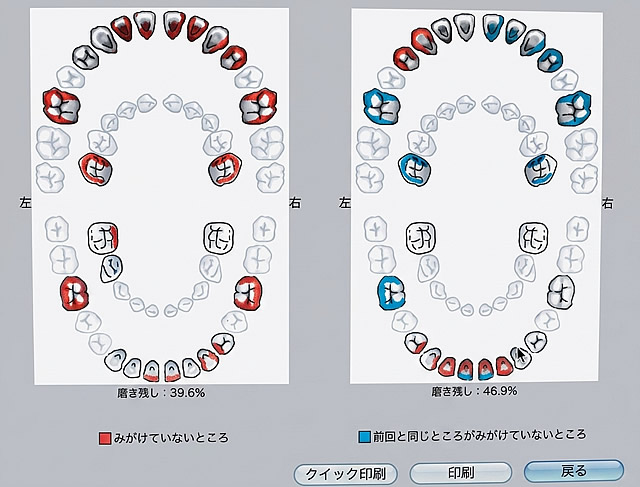 患者説明ソフト