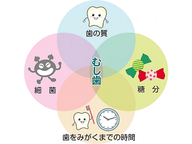 むし歯をつくる4条件