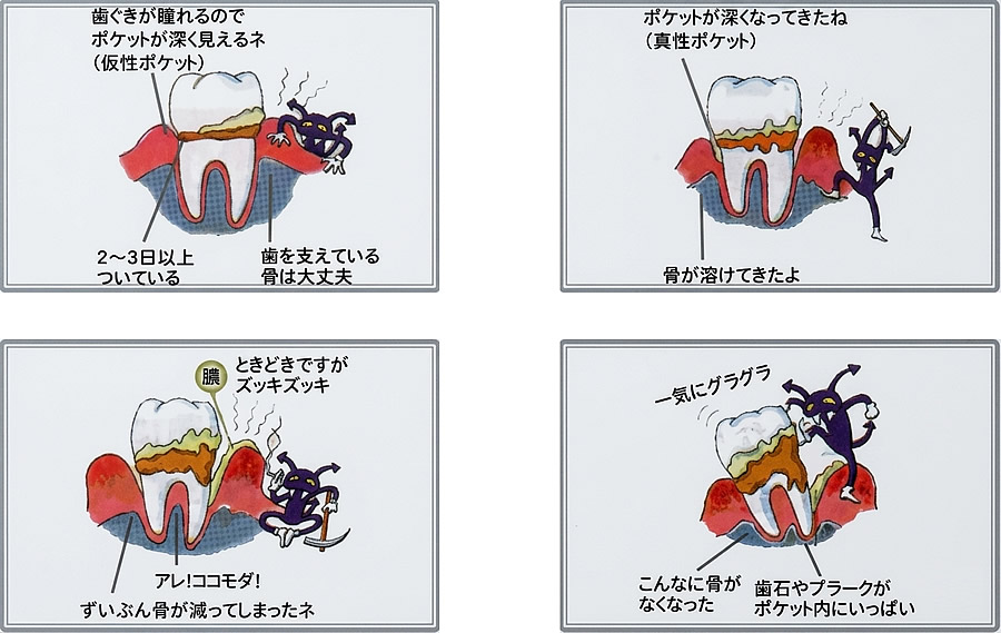 歯磨きをした時に出血したりしませんか