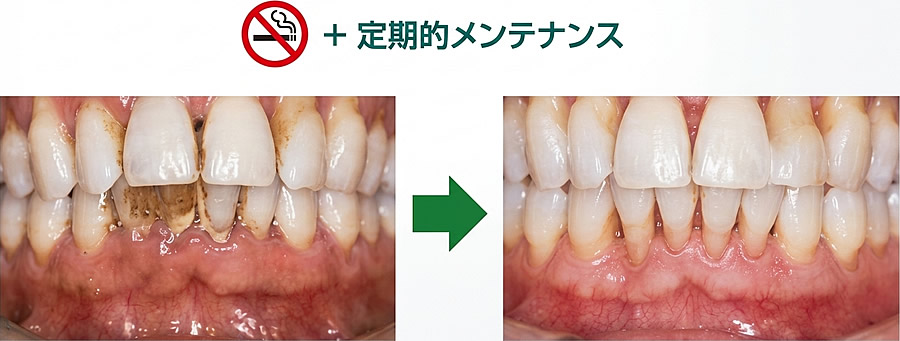 定期的なメンテナンス