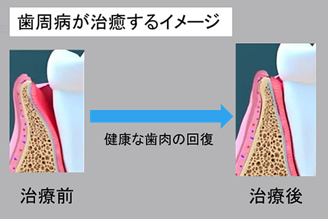 治療イメージ